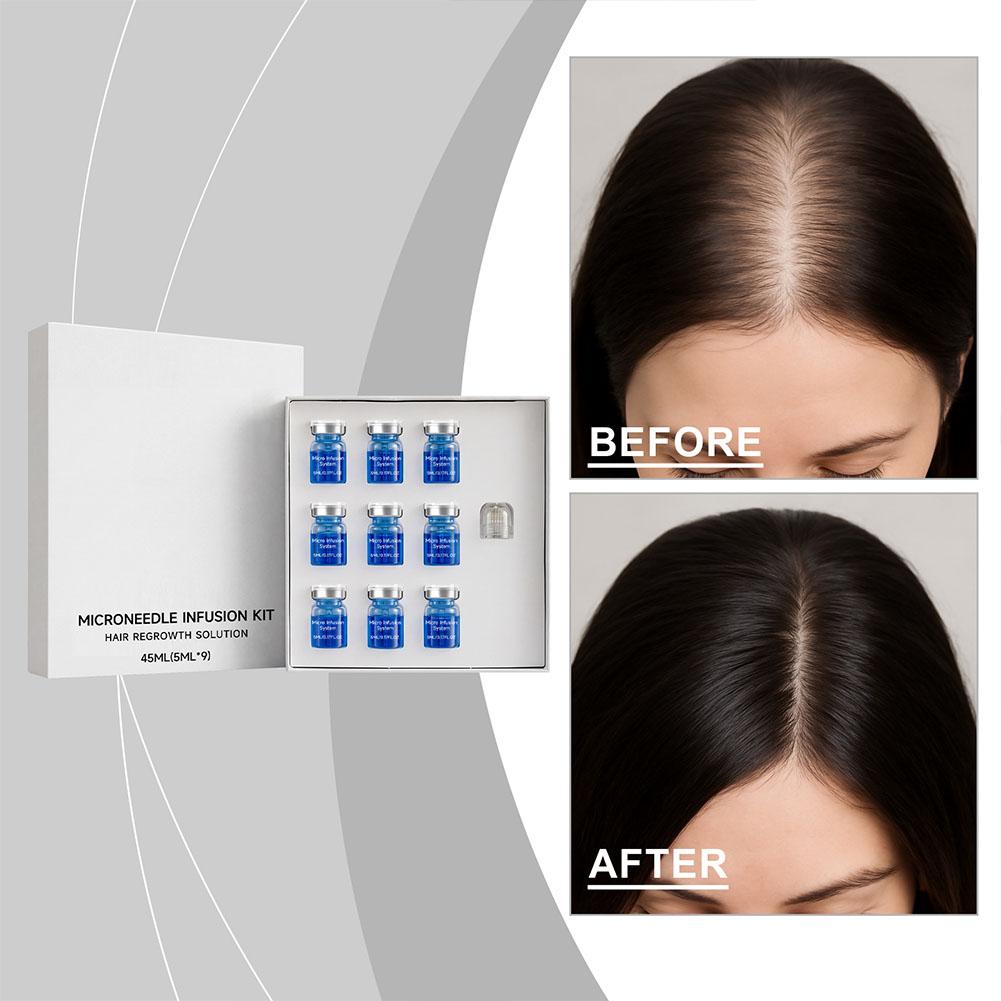 Set de Rodillo de Microagujas  - Hair Care Kit reseña y precio